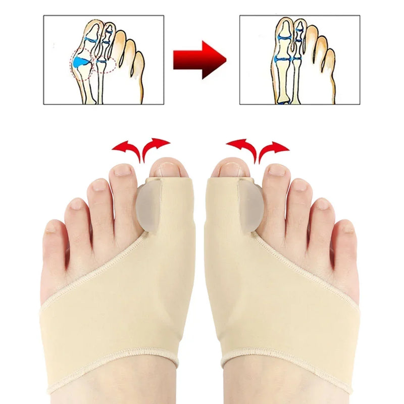 JoanetePro - Super Corretor de Joanete Ortopédico, confortável para alivio das dores.